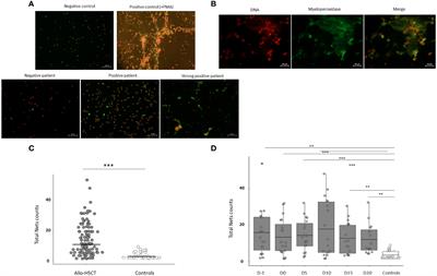 Plasma from patients undergoing allogeneic hematopoietic stem cell transplantation promotes NETOSIS in vitro and correlates with inflammatory parameters and clinical severity